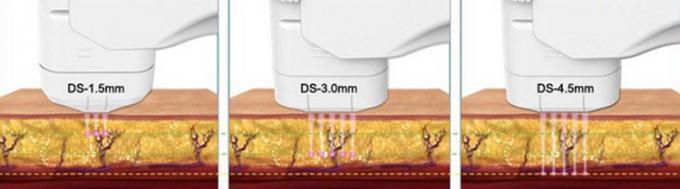 4MHz 11 Lines HIFU Machine with 8 Cartridges for Wrinkle Removal and Anti-aging