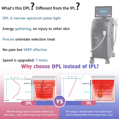 3000W IPL OPT Hair Removal Laser Machine DPL Face Lifting Beauty Machine